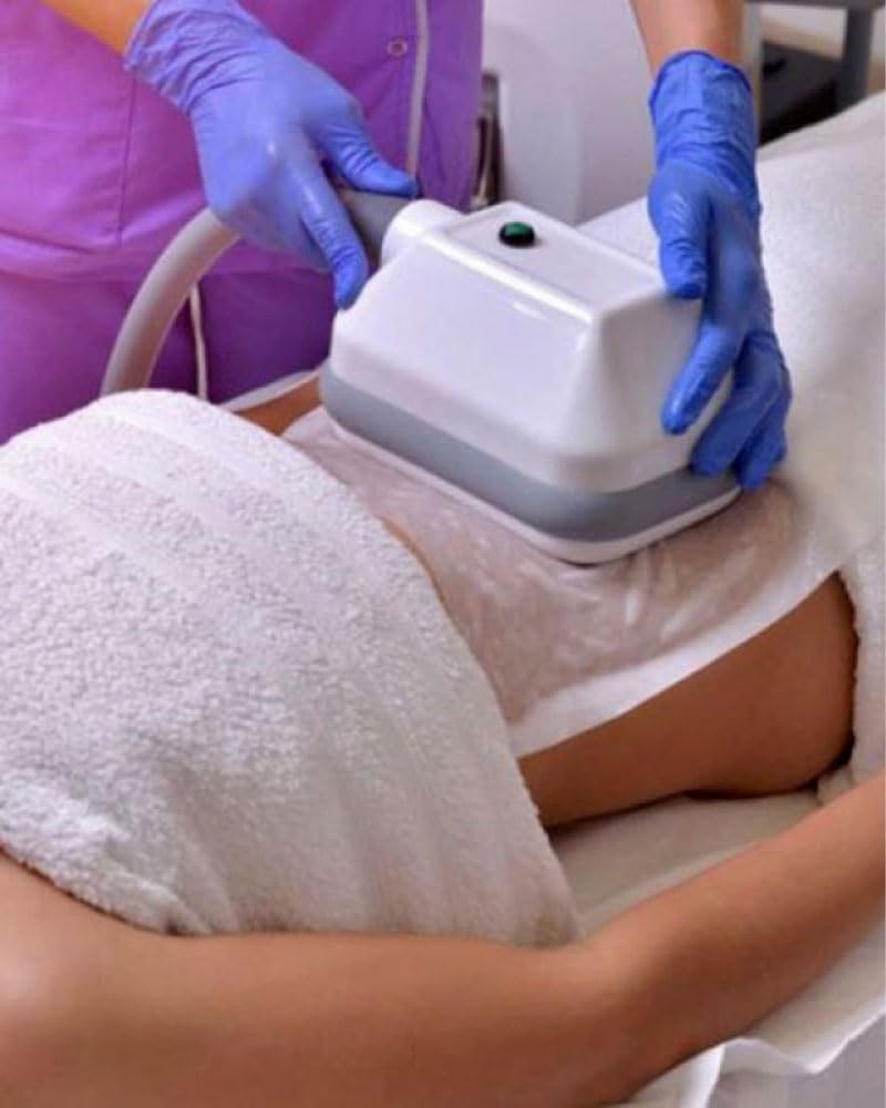 50 membrane Cryolipolysis arricchito con caffeina, L-Carnitina, Aloe Vera. Taglia L (34x42 cm) 110 g
