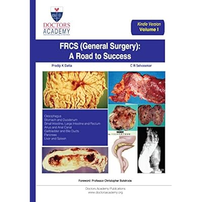 FRCS (General Surgery): The Road to Success (Kindle Edition): Volume I