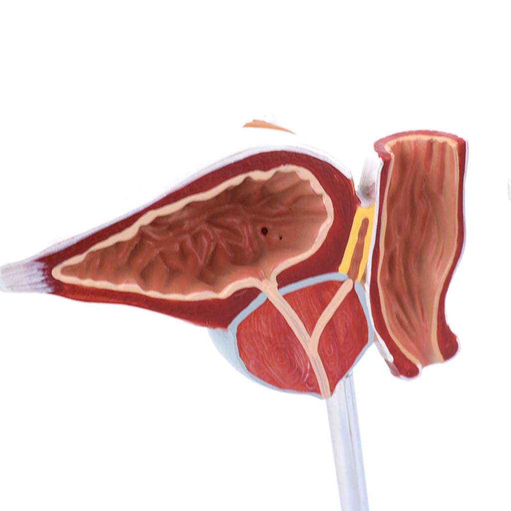 Model Prostaty Naturalnej Wielkości - Prezentacja Normalnych I Uszkodzonych Modeli Prostaty Porównaj Modele - Materiał Pcv Modele Naukowe Anatomii Człowieka - Do Wyświetlania W Badaniach Model Naucza