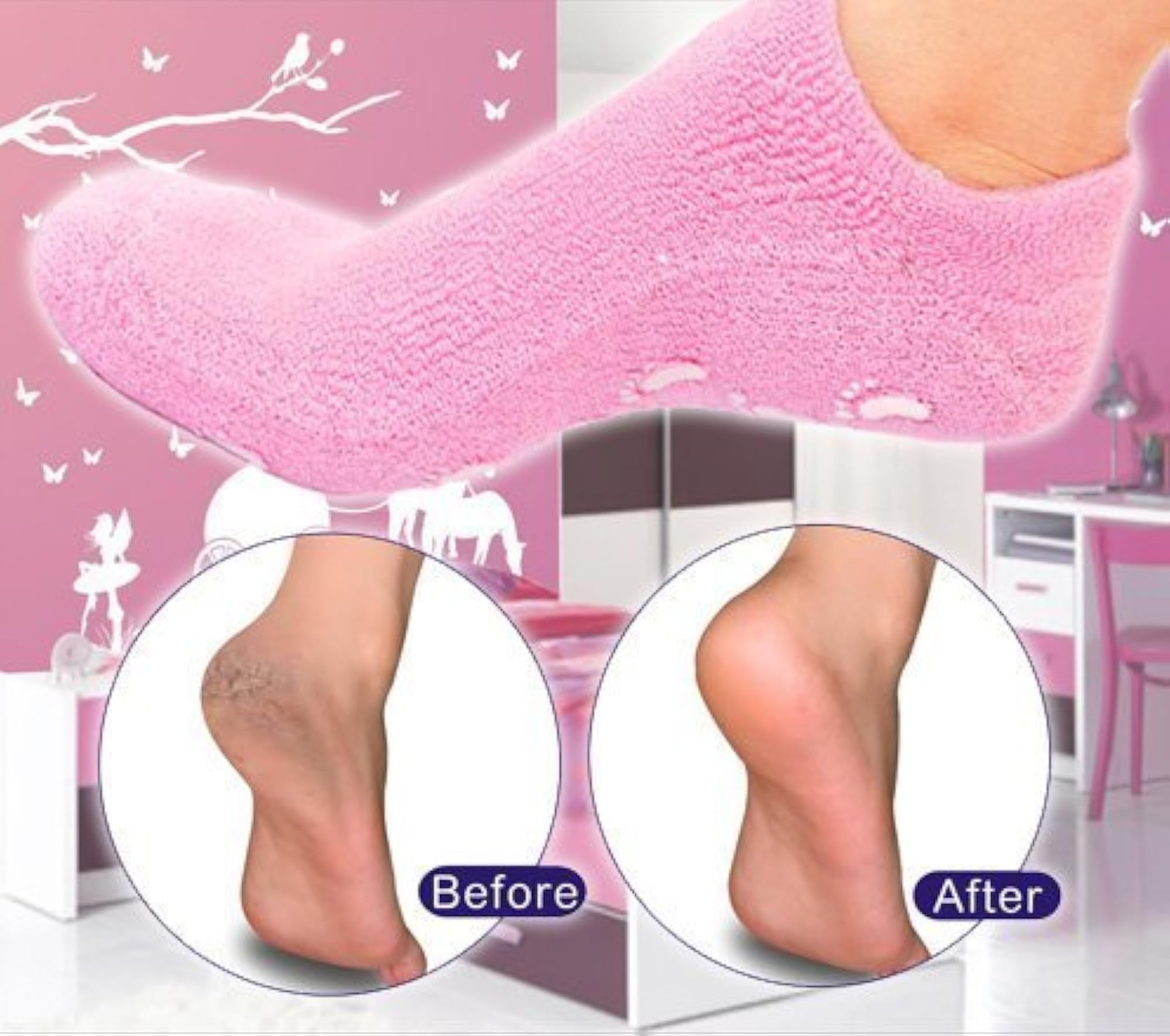 Spa Moisturizing Gel Socks for Dry Feet and Ankles