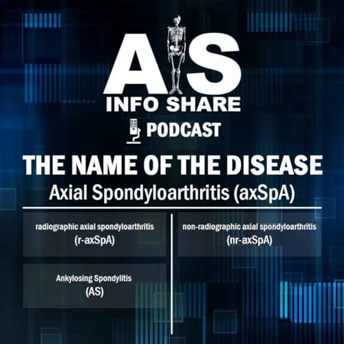 Couverture de The Name of the Disease