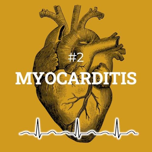 #2 Myocarditis