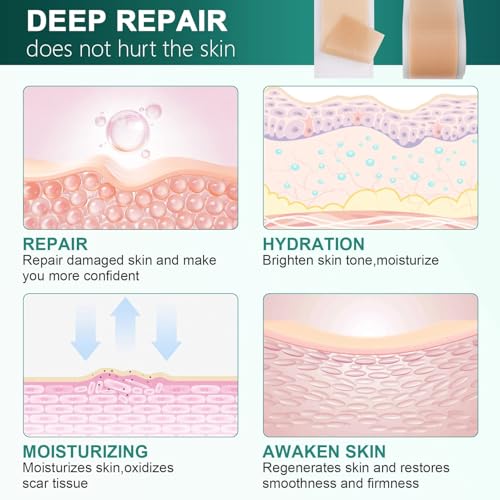 image for AirroYE Silicone Scar Sheets, Silicone Scar Tape (1.6