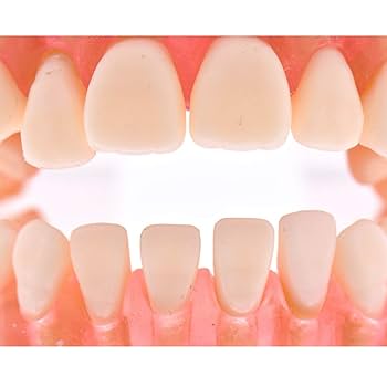 Amazon.co.jp: Angzhili 歯列模型 歯が抜く説明モデル 説明