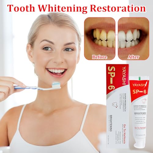 Sp-6 Zahnpasta,Sp6 Zahnpasta,120g Probiotische Zahnpasta,Sp-6 Probiotic Zahnpasta,Sp 6 Probiotische Zahnpasta Zur FleckenentfernungZur Entfernung Von Zahnaufhe – Bild 4