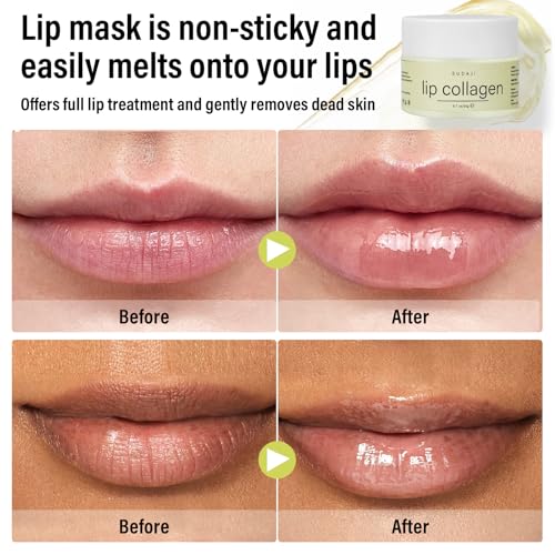 El Mejor Listado de Colageno para labios los 5 mejores. 23 Imagen adicional