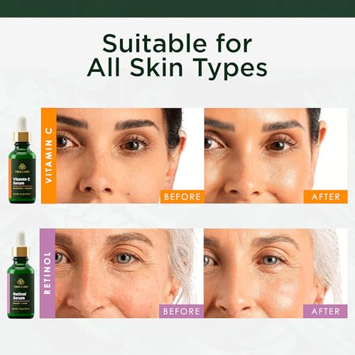 Image of Tree of Life Face Serum Skin Care Set, Vitamin C & Retinol Serum for Face