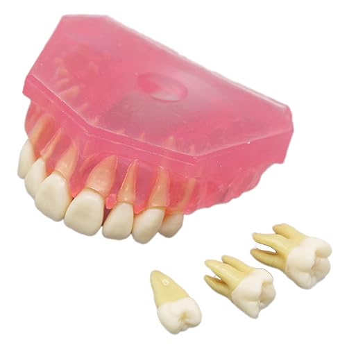 Miniatura 4 de Modelo de dientes de demostración dental - Estudio estándar de enseñanza dental con todos los dientes extraíbles #4004 Material de gel de sílice