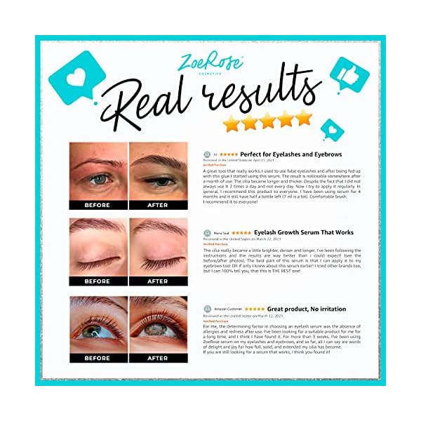 Eyelash-Growth-Serum-Multipurpose-Serum-to-Boost-Lash-Eyebrow-Growth-Made-in-USA-Premium-Eyebrow-Growth-Serum-with-Biotin-Collagen-Keratin-for-Long-Thick-Lashes-and-Eyebrows-7ml ZoeRose COSMETICS Eyelash Growth Serum - Boost Lash & Eyebrow Growth - Premium Eyebrow Growth Serum with Biotin, Collagen & Keratin for Long, Thick Lashes and Eyebrows, 0.25 Fl Oz (Pack of 1)