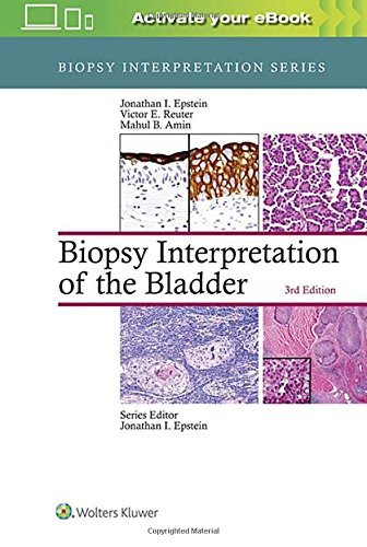 Amazon.in: Buy Biopsy Interpretation of the Bladder by Jonathan Epstein ...