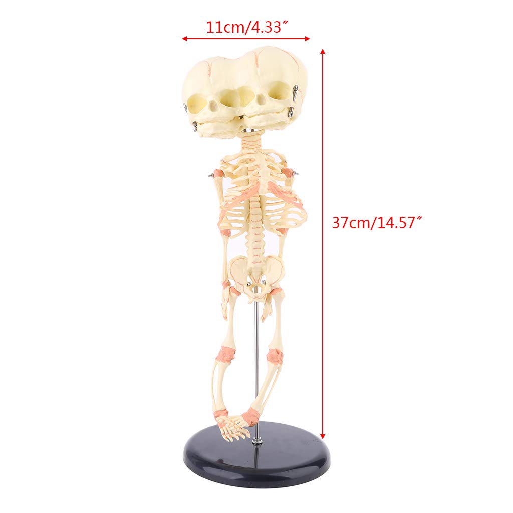 BEIDUOYANG Human Baby Deformed for Head Skull Research Model Skeleton Anatomical Anat Human Skull Model Life Size, As Described