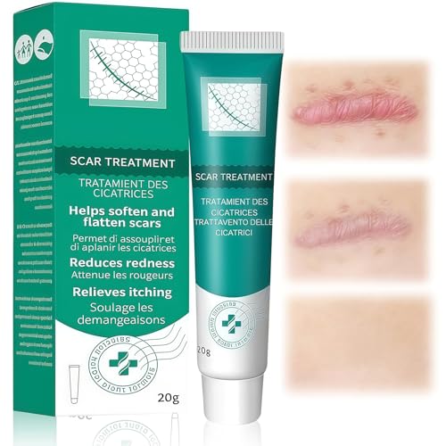 #VerdientProvisionen<br>20g Hautpflege Gel Feuchtigkeitspflege Creme Reduziert Hautunebenheiten Verbesserung Der Rauen Haut Einfach Auftragen Tägliche Pflege Für Männer und Frauen
