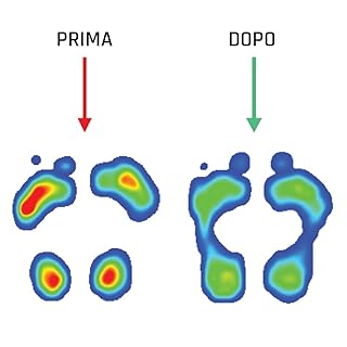 Solette Metatarsalgia SMOU Meta – Sollievo per Neuroma di Morton e Dolore all’Avampiede – Con Cuscinetti Metatarsali e Memory Foam – Ammortizzazione e Comfort – Uomo Donna Uso Quotidiano