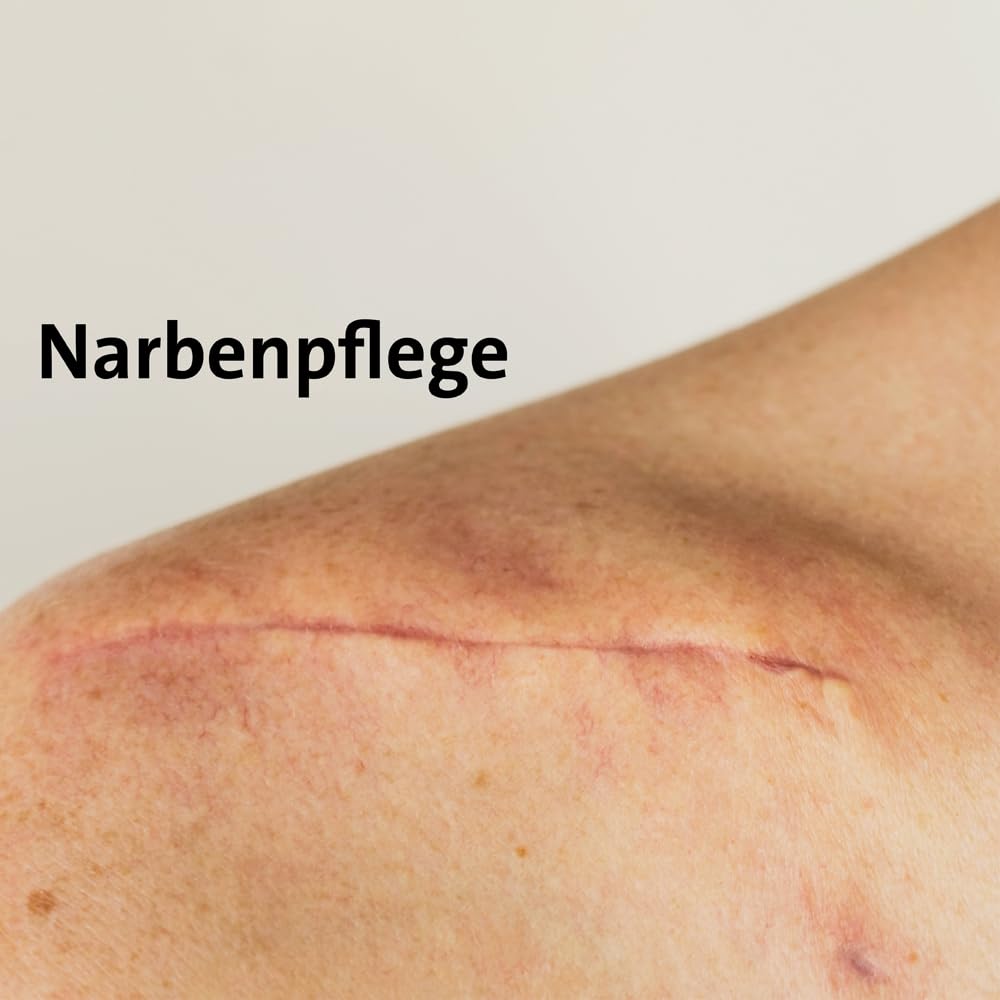 BALLISTOL 26240 NEO-BALLISTOL Hausmittel 1L – Massageöl zum Einreiben, Einmassieren –Wundbehandlung, Desinfizierend