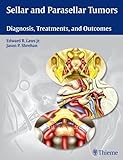 Sellar and Parasellar Tumors: Diagnosis, Treatments, and Outcomes