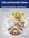 Sellar and Parasellar Tumors: Diagnosis, Treatments, and Outcomes