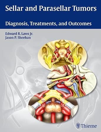 Sellar and Parasellar Tumors: Diagnosis, Treatments, and Outcomes book cover