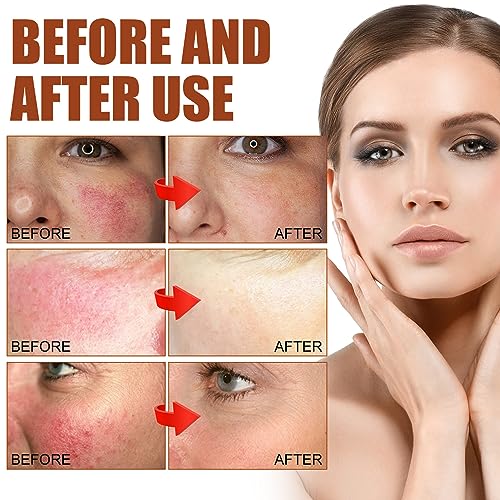 Face Serum Hyaluronic Acid,Face Oil Anti-Aging,Relieve Redness &Quick Sooth Damage Skin,Niacinamide Serum,Replumps & Hydrates,Collagen Face Serum-Protect Skin-Women - Image 2