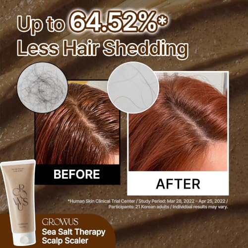 GROWUS Sea Salt Scalp Exfoliator Scrub - Salicylic Acid, Niacinamide, Dexpanthenol, Exfoliating, Deep Cleansing for Itchy, Oily, Greasy Roots and Scalp, No Paraben and Sulfate (4.23 Oz / 120g) - Image 2