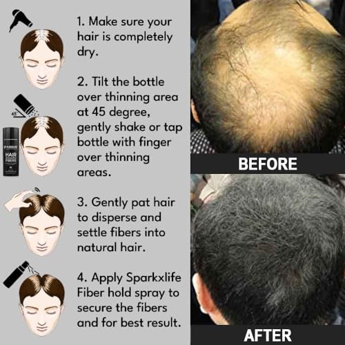 Image of Hair Fiber Medium Brown - Keratin Thick Fiber & Hair Building Fibre for Men & Women - Instant Concealer & Filler powder for Thinning Hairline & Bald Spots (27.5g) (Medium Brown)