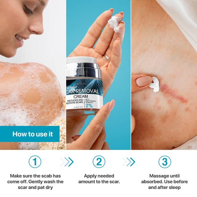 Scar Removal Cream for Women and Men - Rapid Repair of New Old Scars, Acne Spots, Burns All Natural Treatment with Vitamin E, Alanine, Collagen