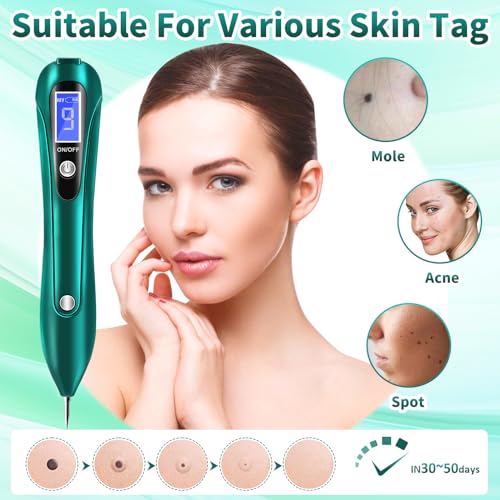 CHRERNA Skin- Tag -Remover Pen, Mole Kit Removal Kit with 9 Strength Levels - Image 3