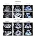 Personalized Prank Pregnancy Ultrasound Photos Fake Positive Pregnancy Test Result Stuff for Adults Spoof Sonogram Checkup Report Props Funny Gag Gifts for Fool's Day (Twins 10 Weeks)