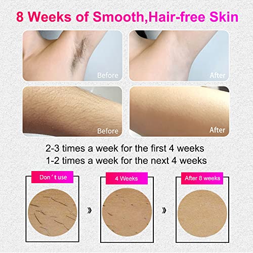 IPL Geräte Haarentfernung 500000 Lichtimpulsen Laser Haarentfernungsgerät für Gesicht Körper Bikinizone Achseln - Image 4