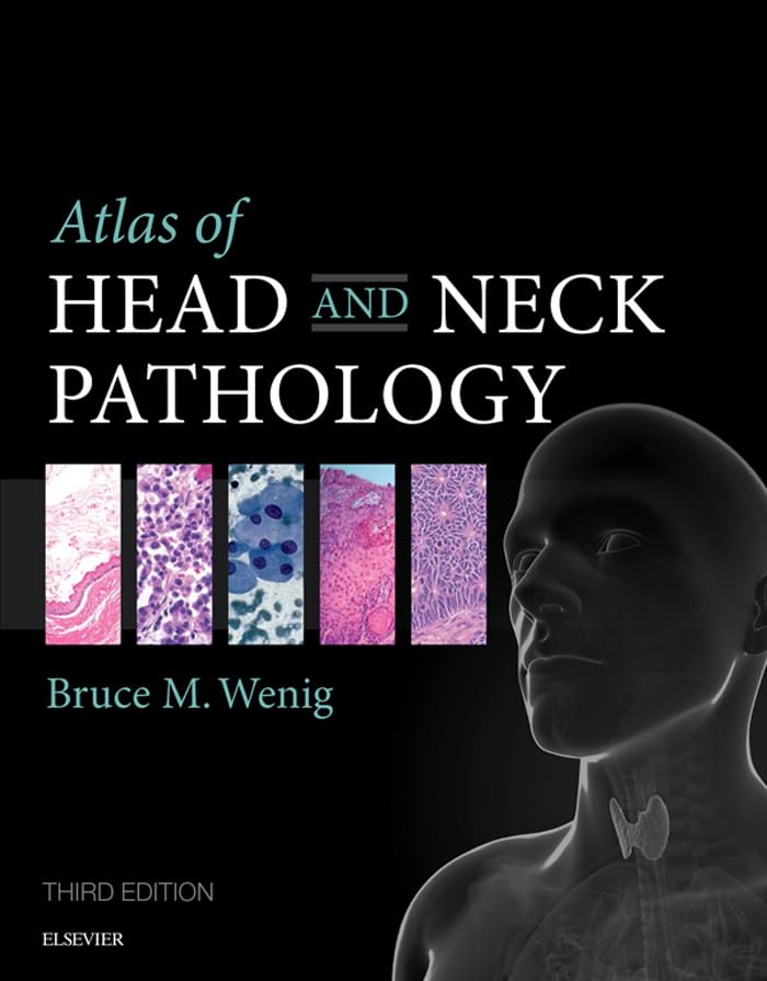 Atlas of Head and Neck Pathology E-Book (Atlas of Surgical Pathology)