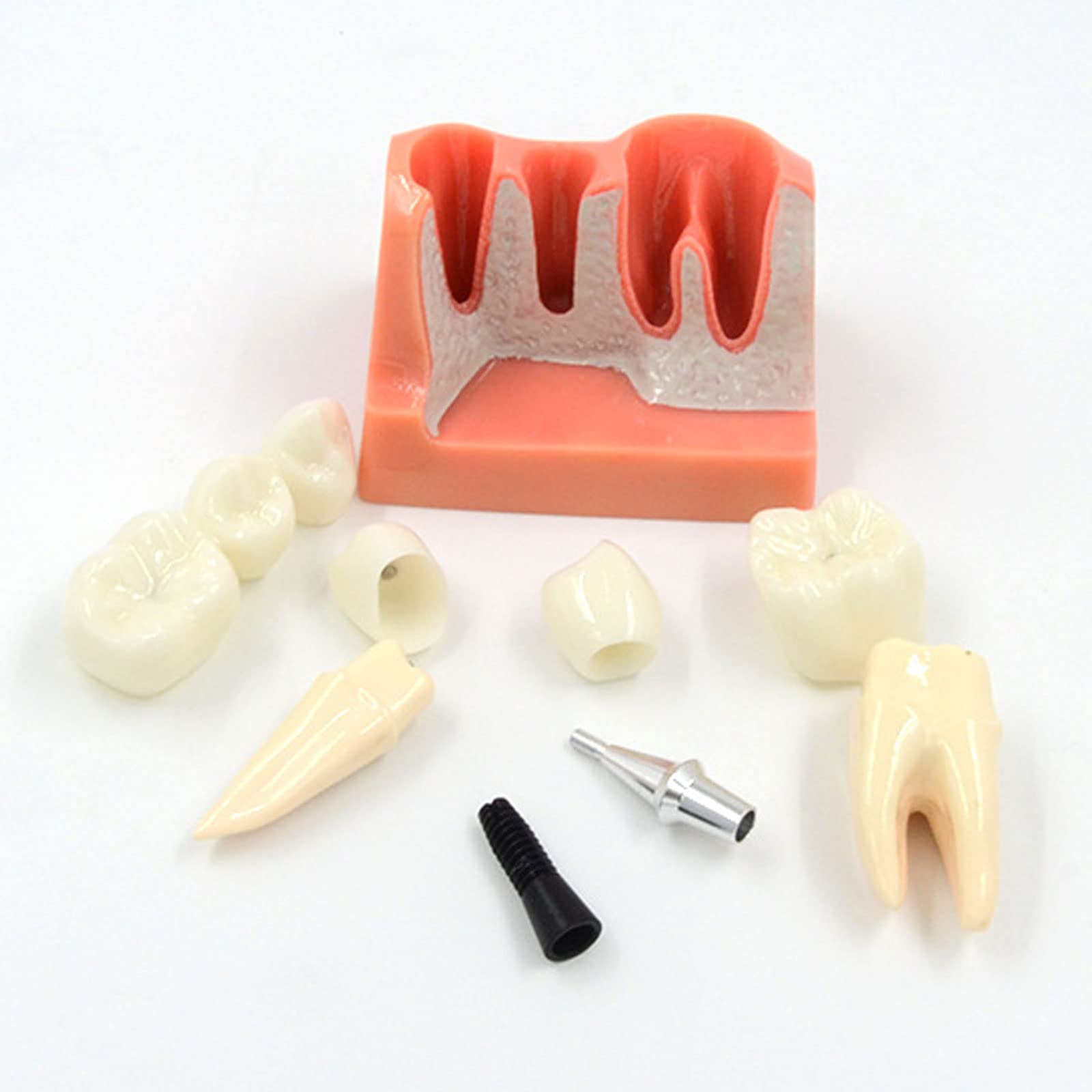 Amovible Modèle D'implant, Modèle Dentaire de Pont de Couronne, Modèle de Dent pour Aidant Le Dentiste et Le Patient à Communiquer et à Discuter du Plan de Traitement, Intuitif et Portable