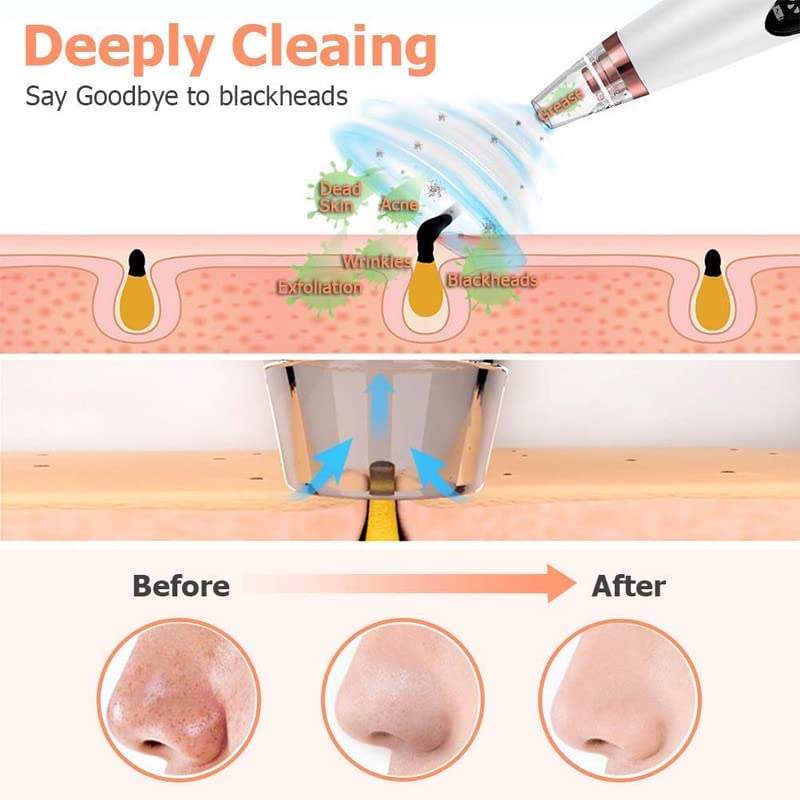 Image of Revin Enterprise Rechargeable 6 in 1 Multi-Functional Cleaning Blackhead Whitehead Extractor Remover Device Acne Pimple Pore Cleaner Vacuum Suction Tool for Men and Women. (Derma Suction 6 in 1-1)