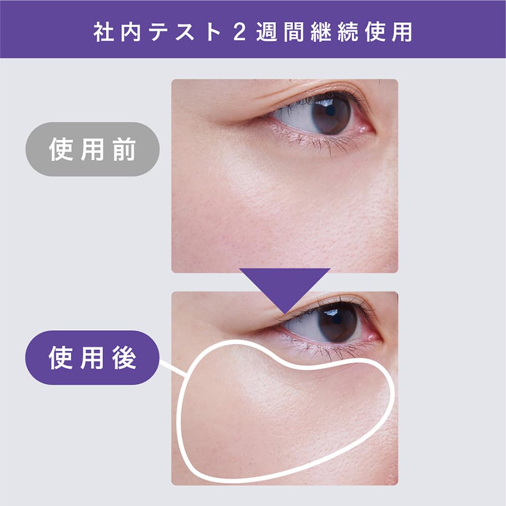 Amazon.co.jp: 美容液 FaceFace by APP モイストリペアエッセンス 薬用 