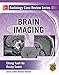 Radiology Case Review Series: Brain Imaging