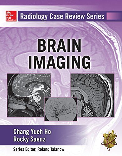 Radiology Case Review Series: Brain Imaging Radiology Case Review Series: Brain Imaging