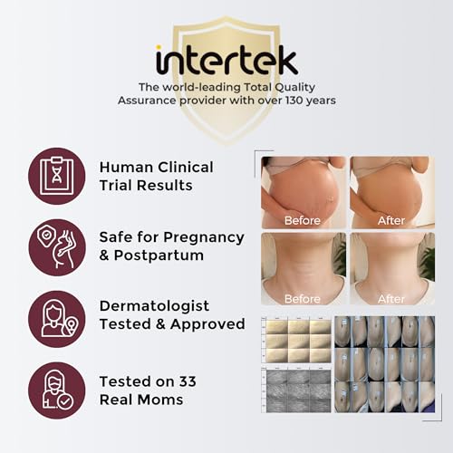Image of Momcozy Stretch Mark Cream, EWG Verified & Dermatologist Tested, 4x Peptide & Centella Oil Capsule Belly Moisturizer for Pregnancy, Nourishes Dry Skin, 5.29 oz (150g)