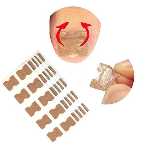 Tratamiento de uñas encarnadas, 50 calcomanías de corrección de uñas encarnadas, parches correctores de uñas de los pies, herramienta profesional de