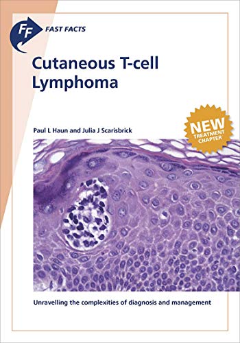 Fast Facts: Cutaneous T-cell Lymphoma (English Edition)
