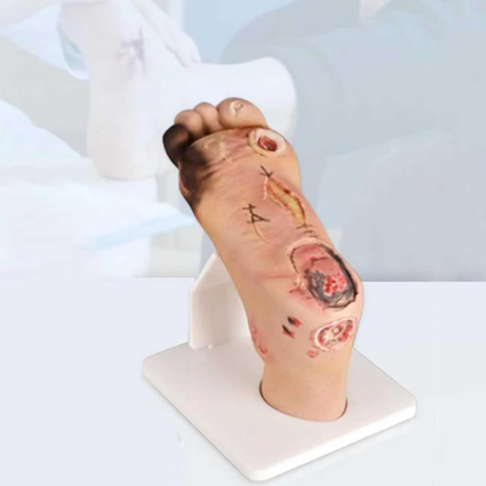 GNbow Human Diabetic foot Pathology Model with 1-3 Mild or 4-5 Severe Purulent Wound Lesions, Realistic Pathological Tool, Diabetic Foot Model for Nursing Teaching, Anatomy