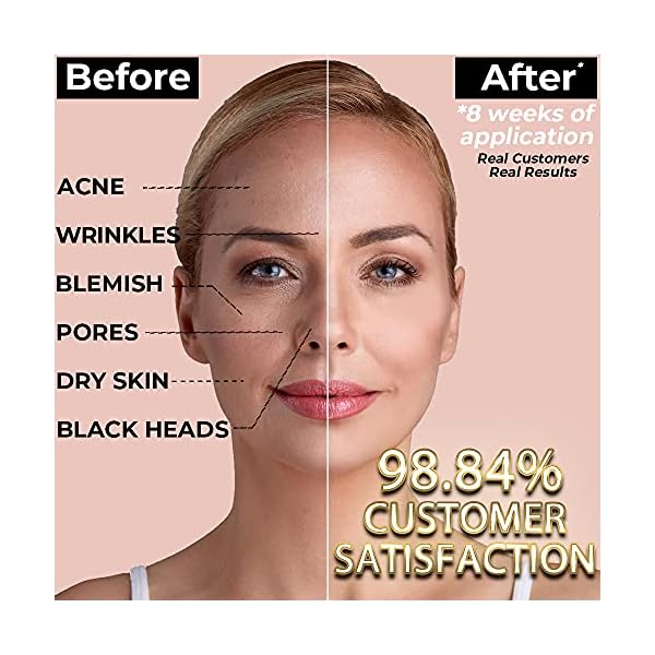 Collagen-Vitamin-C-Clay-Face-Mask-for-Skin-Care-Reduces-Wrinkles-Acne-Blemishes-Blackheads-Deep-Cleansing-Face-Mask-Brightens-Skin-Minimizes-Pores-Moisturize-Purify EVENCÔME Collagen + Vitamin C Clay Face Mask for Skin Care | Reduces Wrinkles, Acne, Blemishes & Blackheads | Deep Cleansing Face Mask | Brightens Skin, Minimizes Pores, Moisturize & Purify