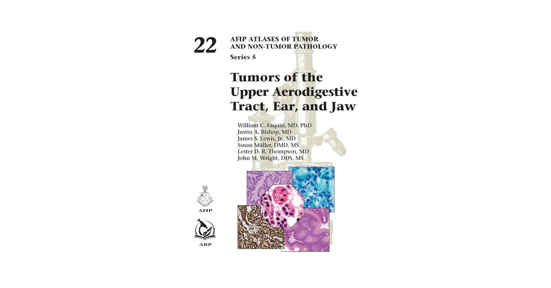 Non-Neoplastic Disorders of the Lower Respiratory Tract (Atlas of Non-Tumor Pathology， Series 1，) [ハードカバー] Travis， William D.， M.D.; Armed Forces Institute of Pathology Non-Neoplastic Disorders of the Lower Respiratory Tract