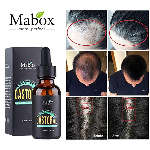 MABOX Fast Powerful Hair Growth Essence Products Essential Oil Liquid Treatment Preventing Hair Loss Hair Care Andrea 30ml