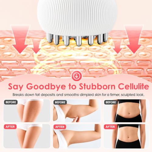 Image of Lymphatic Drainage Massager & Anti-Cellulite Tool for Legs Arms Belly Sculpting Machine with Microcurrent Light Heat Vibration Reduces Stretch Marks Rechargeable White