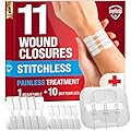 Emergency Wound Closure Strips - 11pk - 2 Types Easy to Use Butterfly Bandages - Stitchless & Painless Laceration Closure Kit