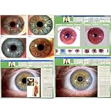 GNbow Analizator tęczówki irys, medyczna kamera iryskopowa, 30-krotne powiększenie tęczówki z oprogramowaniem Iris, rozdzielczość 2560 x 1920