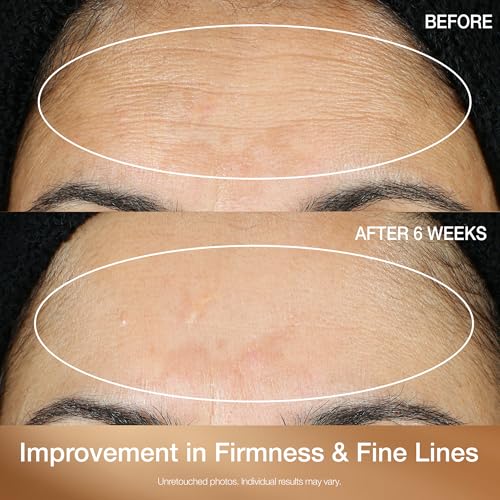 StriVectin Multi Action Super C Retinol Brightening & Correcting Serum 1.7oz - Thumbnail 4
