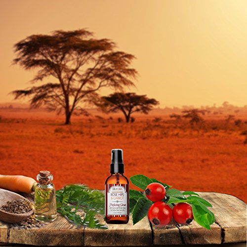 Shea Terra Rose Hips And Carrot Perfecting Serum | Nutrient Rich, All Natural & Organic Oil With Anti-Aging Vitamin A, E And Beta-Carotene For Clear And Glowing Youthful Skin – 2 Oz #TOP2