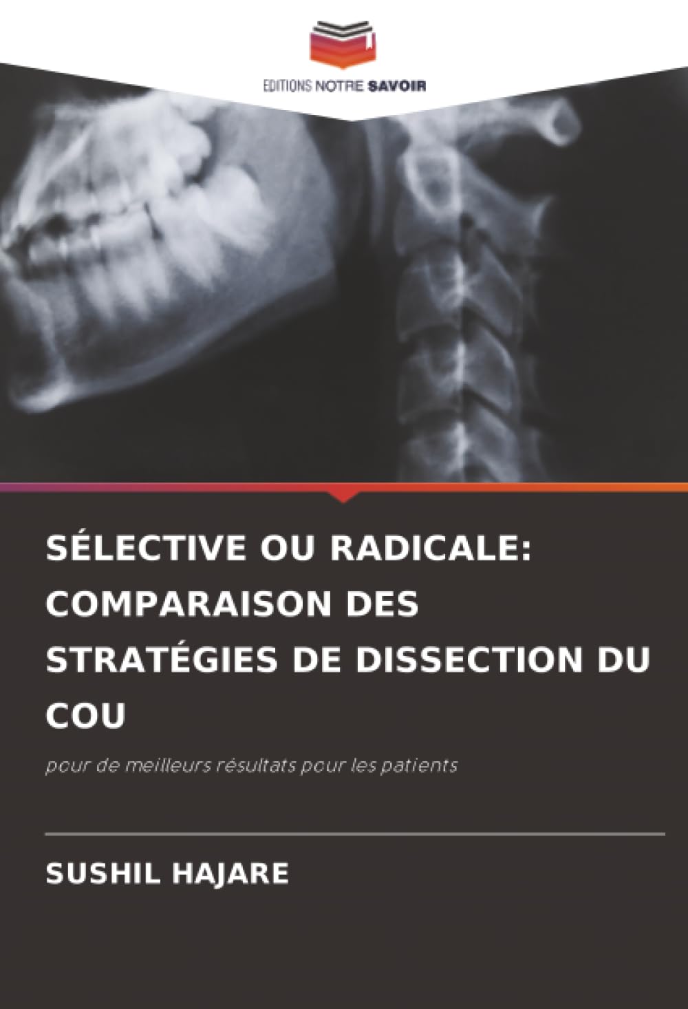 SÉLECTIVE OU RADICALE: COMPARAISON DES STRATÉGIES DE DISSECTION DU COU: pour de meilleurs résultats pour les patients
