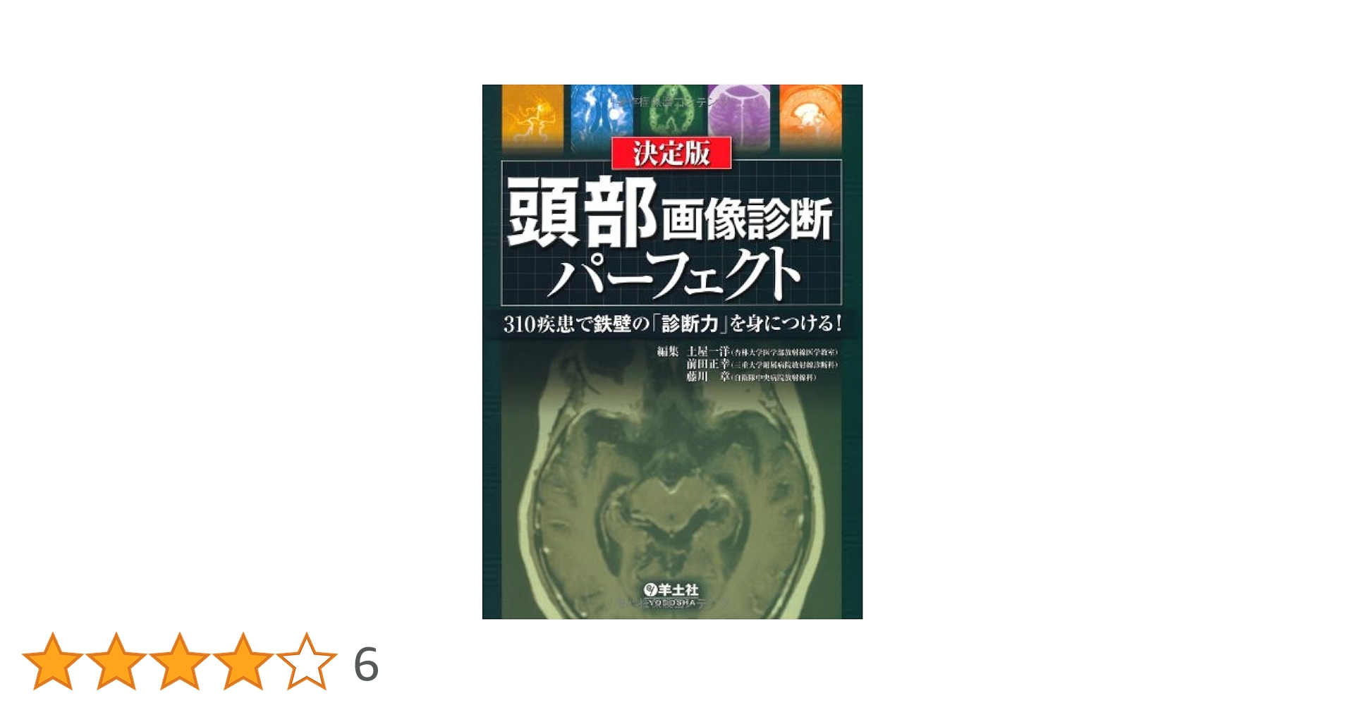 決定版　頭部画像診断パーフェクト [単行本] 土屋 一洋 決定版 頭部画像診断パーフェクト | 土屋 一洋 |本 | 通販 | Amazon