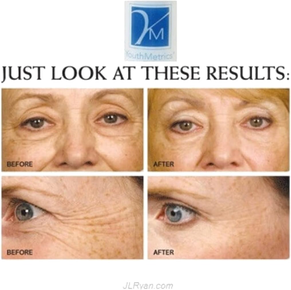 Youth Metrics P3 Stretch Mark Cream Improving Smoothness And Suppleness (1 Oz) - Image 2