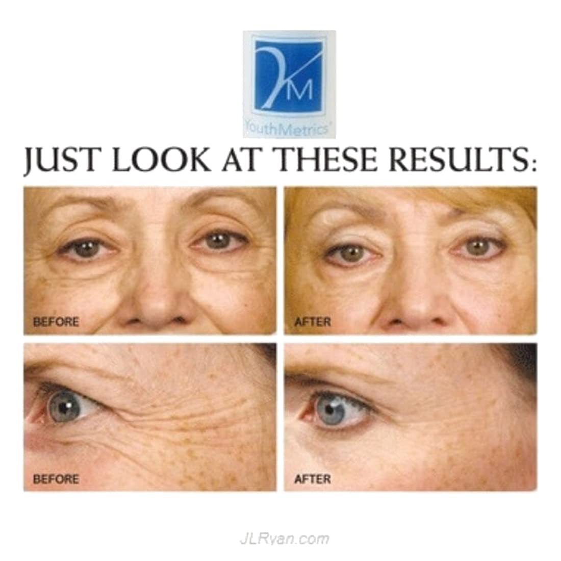 Youth Metrics P3 By Biologic Solutions Stretch Mark Cream Improving Smoothness And Suppleness (1 Oz)